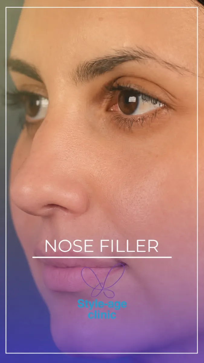 A simple filler touch